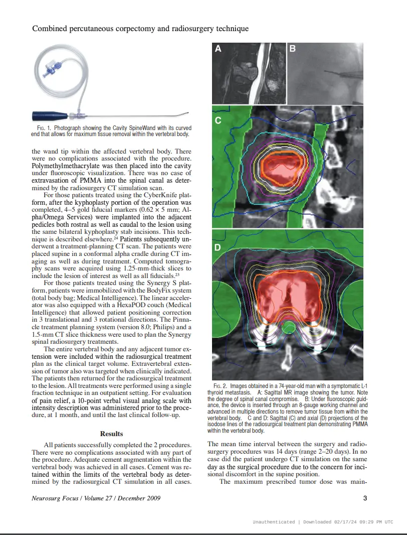 Ablation Wand for tumors